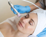 Radiofrecuencia facial