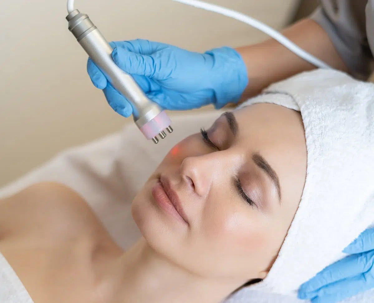 Radiofrecuencia facial